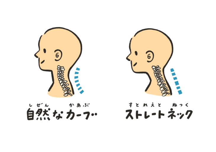 ストレートネックと正しい首の位置/カイロライン多摩・唐木田整体室